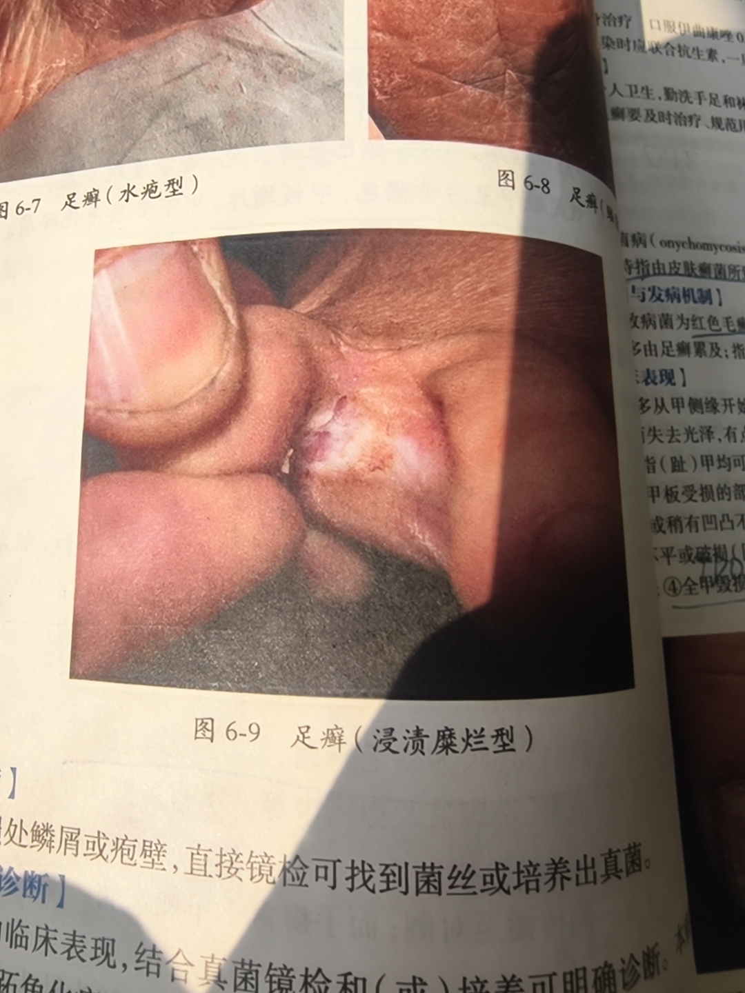 5a981b96cedc221e450ed6387a062d13.jpg