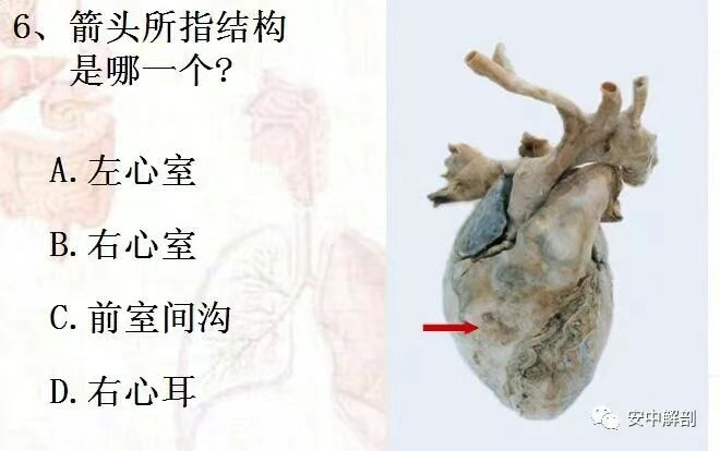 096b8bc2fb26ca752761a8b964ecd5c1.png