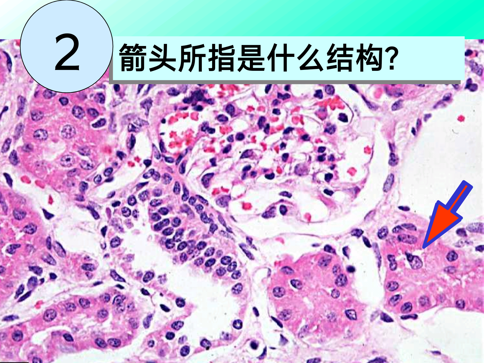 92a298916490ca8d60c33038f6e1f557.png